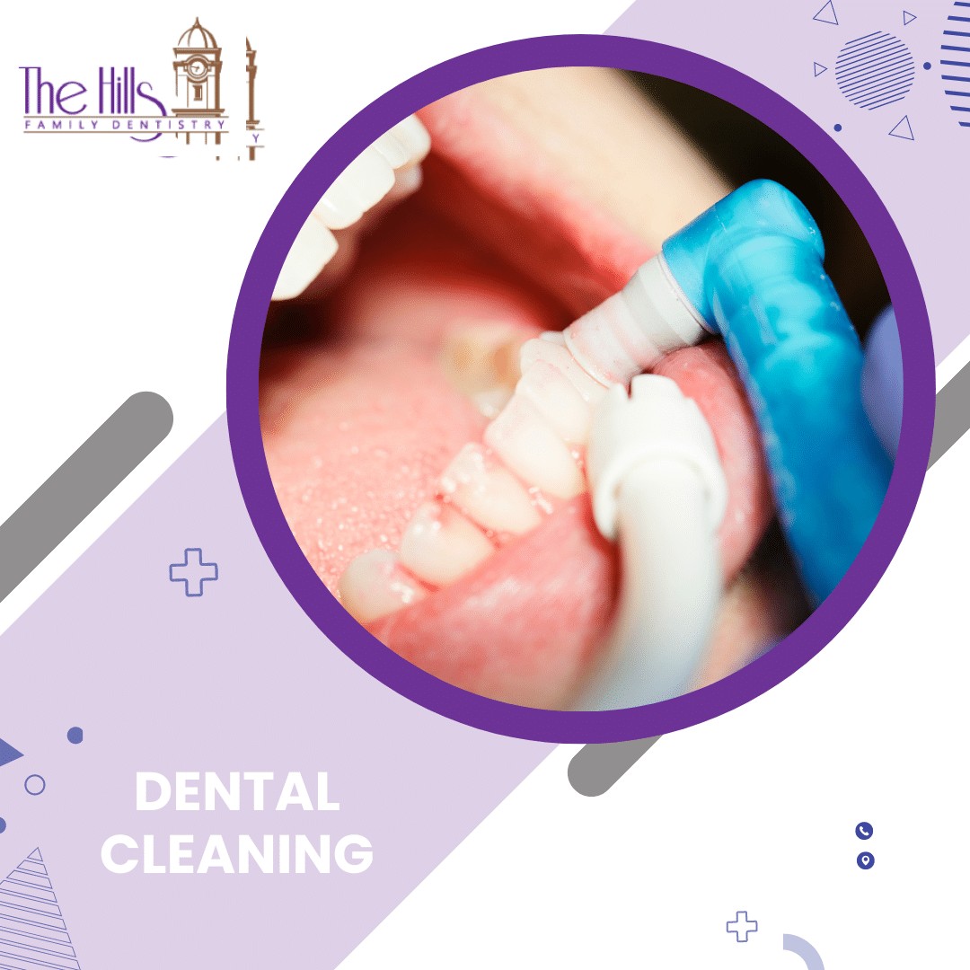 Dental Cleaning from The Best Dental Hygienists in San Marcos - The Hills Family Dentistry