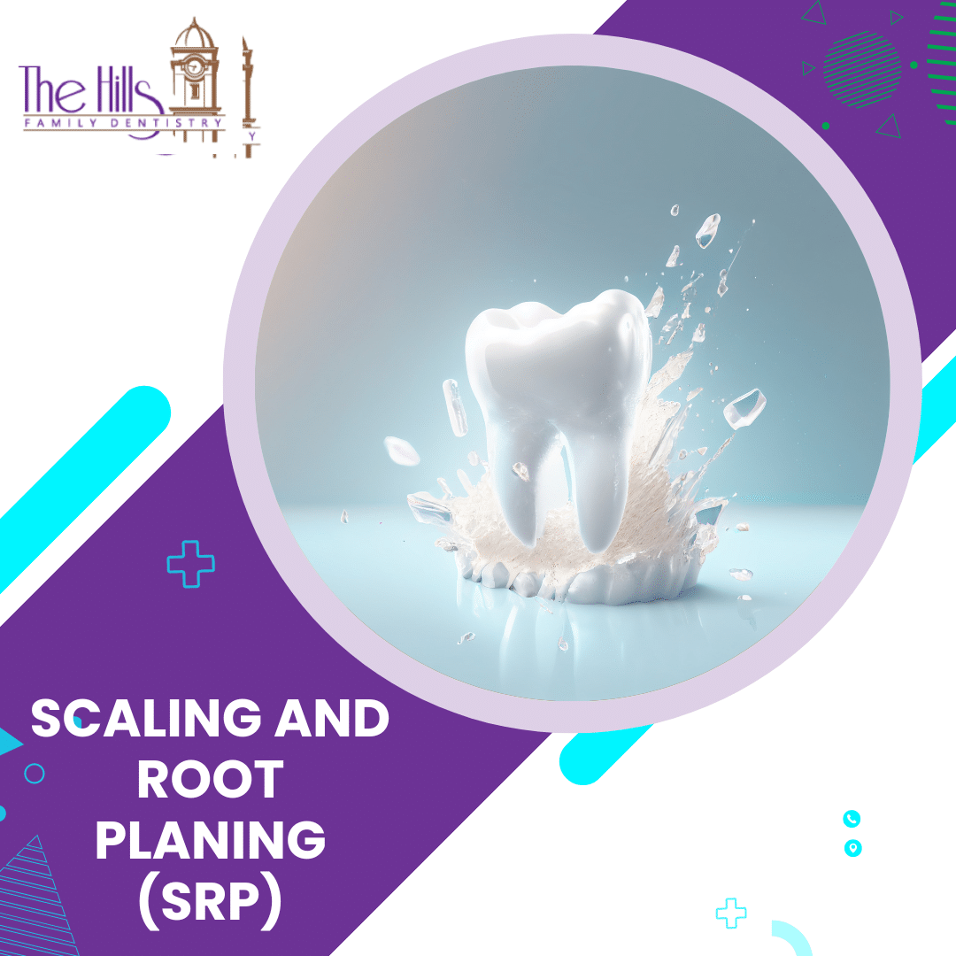 Scaling and Root Planing (SRP) in San Marcos - The Hills Family Dentistry