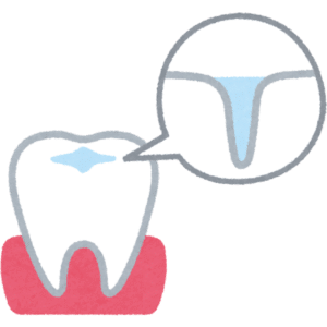 Dental Sealants in San Marcos - The Hills Family Dentistry