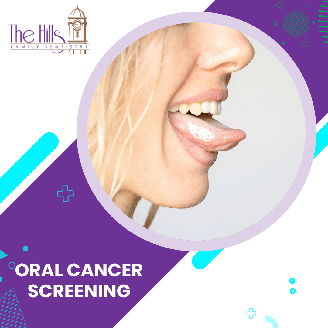 Oral Cancer Screening in San Elijo Hills - The Hills Family Dentistry in San Marcos